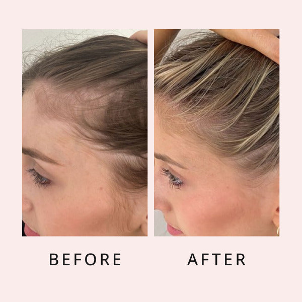 luxe hair growth serum before and after