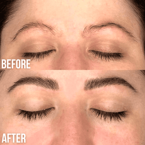 brow lift and tint before and after