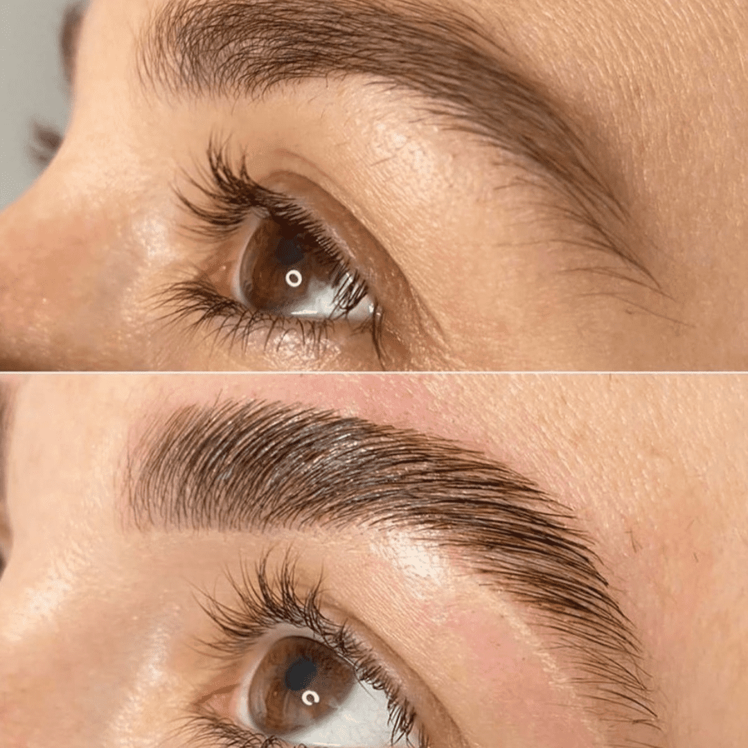 brow lift and tint before and after