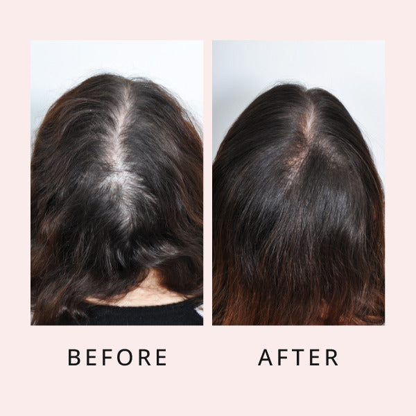 luxe hair growth serum before and after