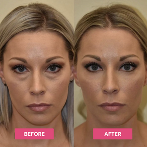 Luxe - Korean Under-Eye Balm Luxe Research