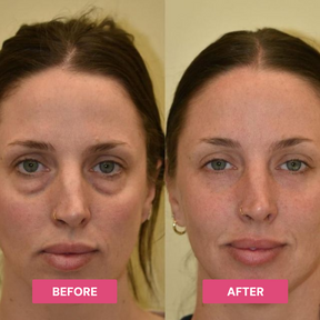 Luxe - Korean Under-Eye Balm Luxe Research