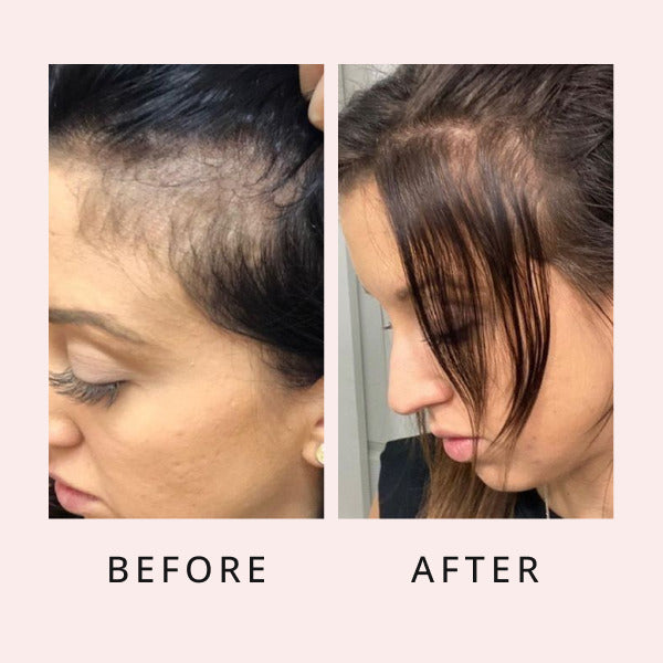 luxe hair growth serum before and after