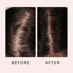 luxe hair growth serum before and after